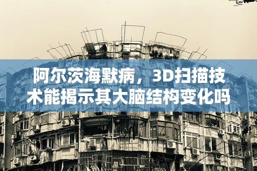 阿尔茨海默病，3D扫描技术能揭示其大脑结构变化吗？