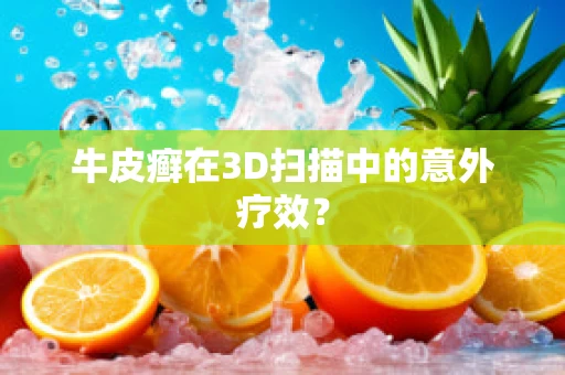 牛皮癣在3D扫描中的意外疗效？
